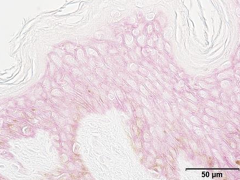 Control (Young skin)