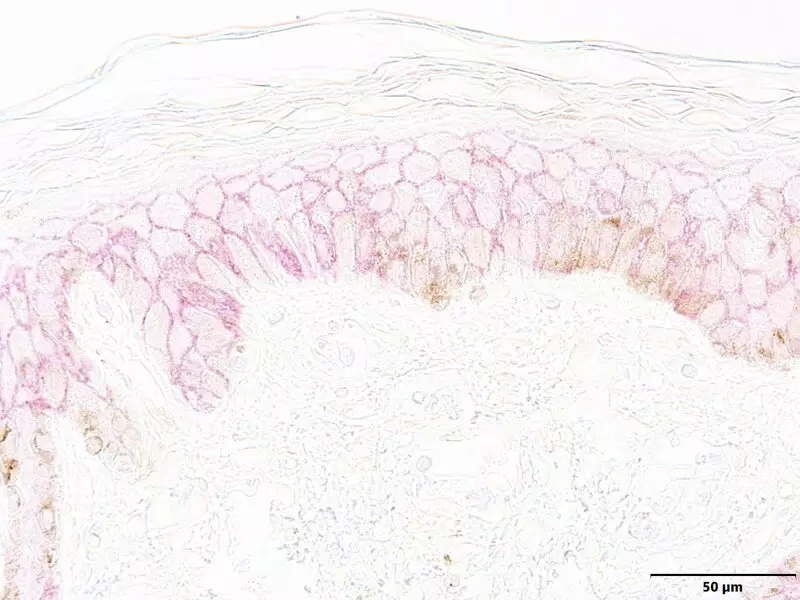 Second Image
