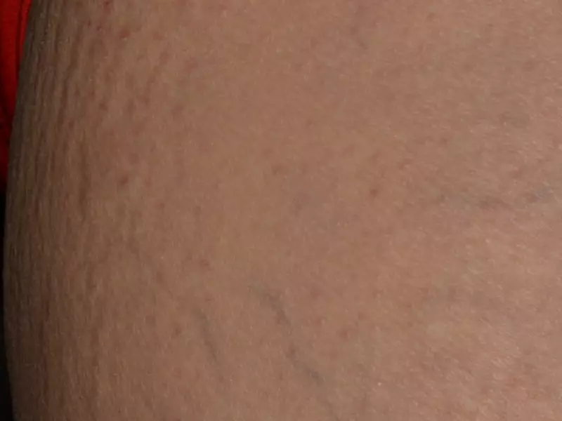 Day 0