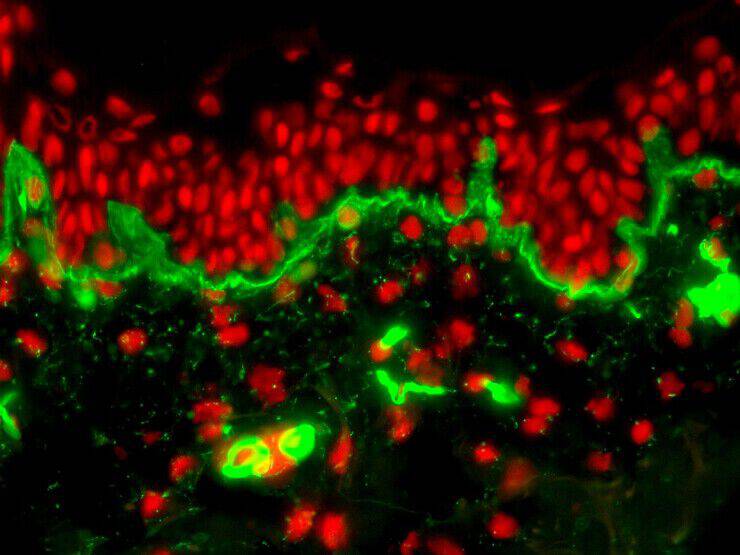 Pro-XylaneTM in a Bandage Cream Technology Image